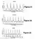 Fig. 14 - Diagnostic classifications of pulse signal waveform data