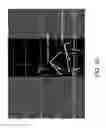 Fig. 13 - Electroanatomical mapping