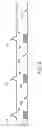 Fig. 03 - Electroanatomical mapping
