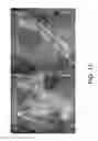 Fig. 12 - Electroanatomical mapping