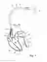 Fig. 02 - IMPLANTABLE MEDICAL DEVICE AND METHOD FOR MULTISITE MEASUREMENT OF INTRACARDIAC IMPEDANCE