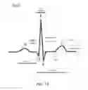 Fig. 02 - Systems and methods for increased specificity in diagnostics