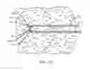 Fig. 11 - METHODS AND DEVICES FOR REMOVING TISSUE FROM A PATIENT AND PLACING A MARKER IN THE PATIENT