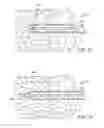 Fig. 15 - METHODS AND DEVICES FOR REMOVING TISSUE FROM A PATIENT AND PLACING A MARKER IN THE PATIENT