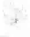 Fig. 40 - Adaptive arm support systems and methods for use