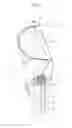 Fig. 14 - Lower back assistance apparatus