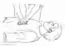 Fig. 01 - Hand Mounted CPR Chest Compression Monitor