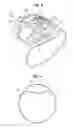 Fig. 03 - VIBRATING BAND