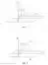 Fig. 09 - Non-invasive method of spinal intervention and use of devices effective for spinal intervention
