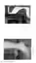 Fig. 02 - Orthotic device and method
