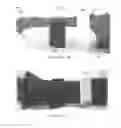 Fig. 06 - Orthotic device and method