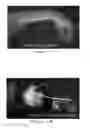 Fig. 07 - Orthotic device and method