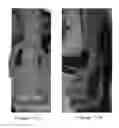 Fig. 08 - Orthotic device and method