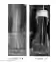 Fig. 09 - Orthotic device and method