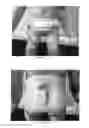 Fig. 12 - Orthotic device and method