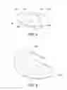 Fig. 04 - ARCH SUPPORT WRAP