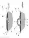 Fig. 11 - Shape and Pressure Adjustable Dressing for Blisters Caused by Burn and the Like
