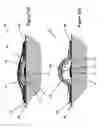 Fig. 12 - Shape and Pressure Adjustable Dressing for Blisters Caused by Burn and the Like