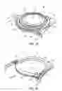 Fig. 02 - Apparatus and methods for treating excess intraocular fluid