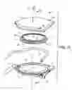Fig. 03 - Apparatus and methods for treating excess intraocular fluid