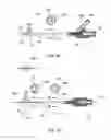 Fig. 04 - Anchors and methods for intestinal bypass sleeves
