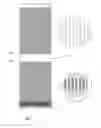 Fig. 08 - Anchors and methods for intestinal bypass sleeves