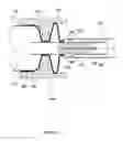 Fig. 13 - Anchors and methods for intestinal bypass sleeves