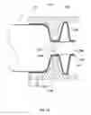 Fig. 15 - Anchors and methods for intestinal bypass sleeves