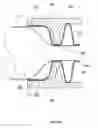 Fig. 16 - Anchors and methods for intestinal bypass sleeves