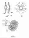 Fig. 28 - Anchors and methods for intestinal bypass sleeves