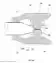Fig. 43 - Anchors and methods for intestinal bypass sleeves