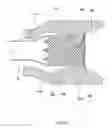 Fig. 48 - Anchors and methods for intestinal bypass sleeves