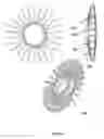 Fig. 55 - Anchors and methods for intestinal bypass sleeves