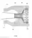 Fig. 61 - Anchors and methods for intestinal bypass sleeves
