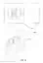 Fig. 74 - Anchors and methods for intestinal bypass sleeves
