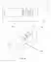 Fig. 76 - Anchors and methods for intestinal bypass sleeves