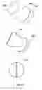 Fig. 92 - Anchors and methods for intestinal bypass sleeves