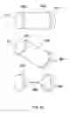 Fig. 93 - Anchors and methods for intestinal bypass sleeves