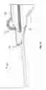 Fig. 13 - Catheter access and control device and method of using same