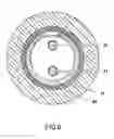 Fig. 08 - Deflectable variable radius catheters
