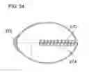Fig. 23 - Slow release liquid drug delivery device