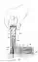 Fig. 01 - Infusion pumps