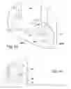 Fig. 19 - Inserter device with horizontal moving part