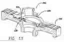 Fig. 09 - Valved sheath introducer for venous cannulation