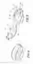 Fig. 07 - Dialysis catheter anchoring system