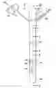 Fig. 01 - Self-illuminating endogastric tubes and method of placing endogastric tubes