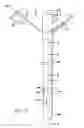 Fig. 03 - Self-illuminating endogastric tubes and method of placing endogastric tubes