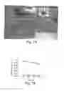 Fig. 11 - BIOARTIFICIAL KIDNEYS