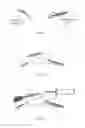 Fig. 08 - Method of performing intra-abdominal tissue aspiration to ameliorate the metabolic syndrome, or abdominal obesity