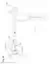 Fig. 15 - Positioning method and apparatus for delivering vapor to the uterus